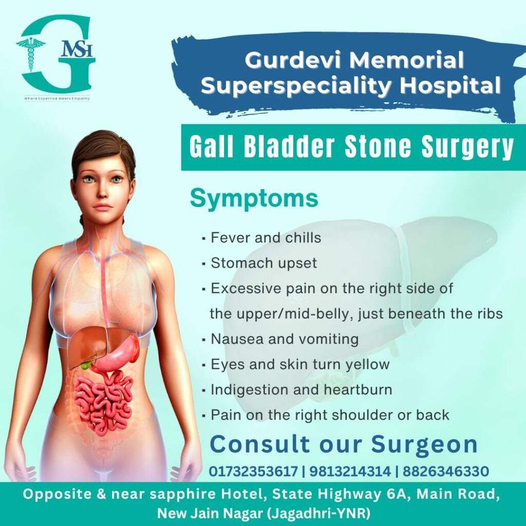 Gallbladder removal surgery in Yamunanagar