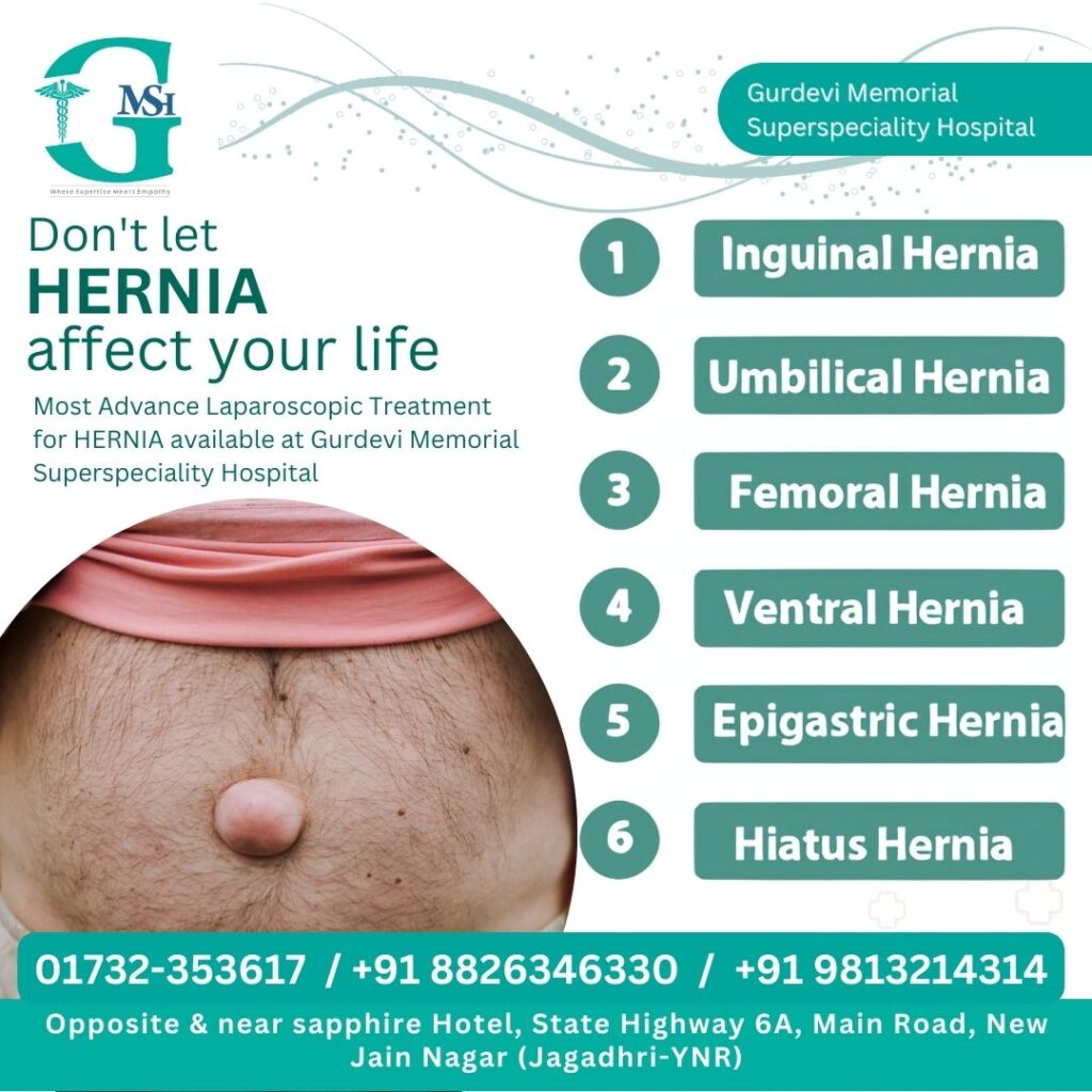 Hernia Operation