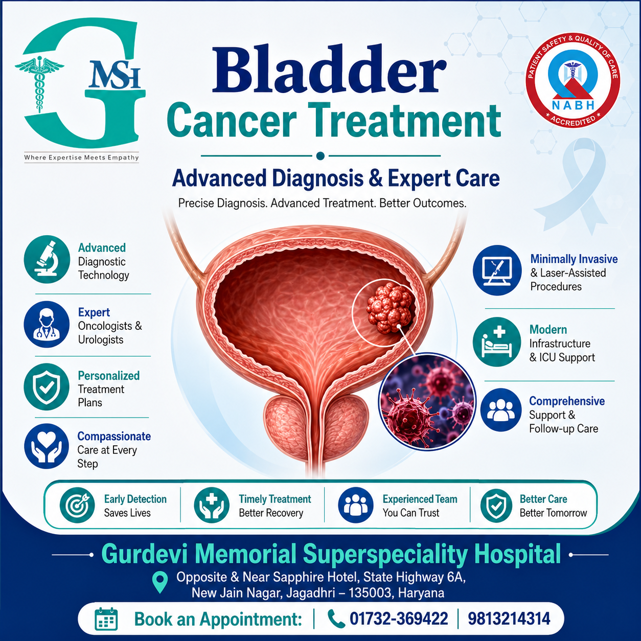 Bladder Cancer Treatment